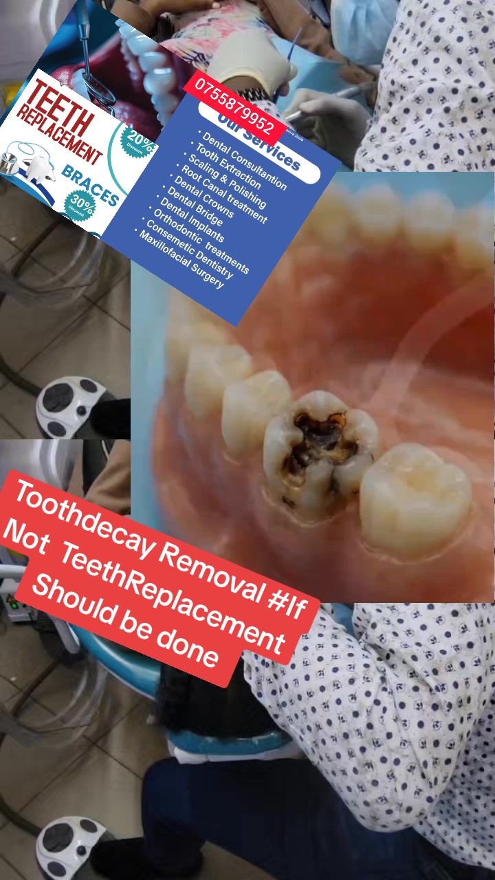@Allianz Dental studio🦷🦷🇺🇬