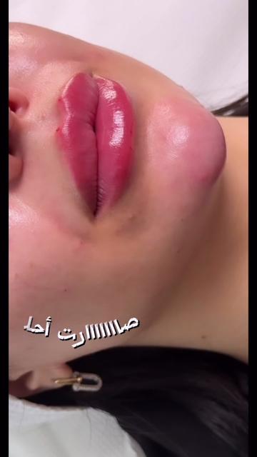 @Dr Taj Hammad