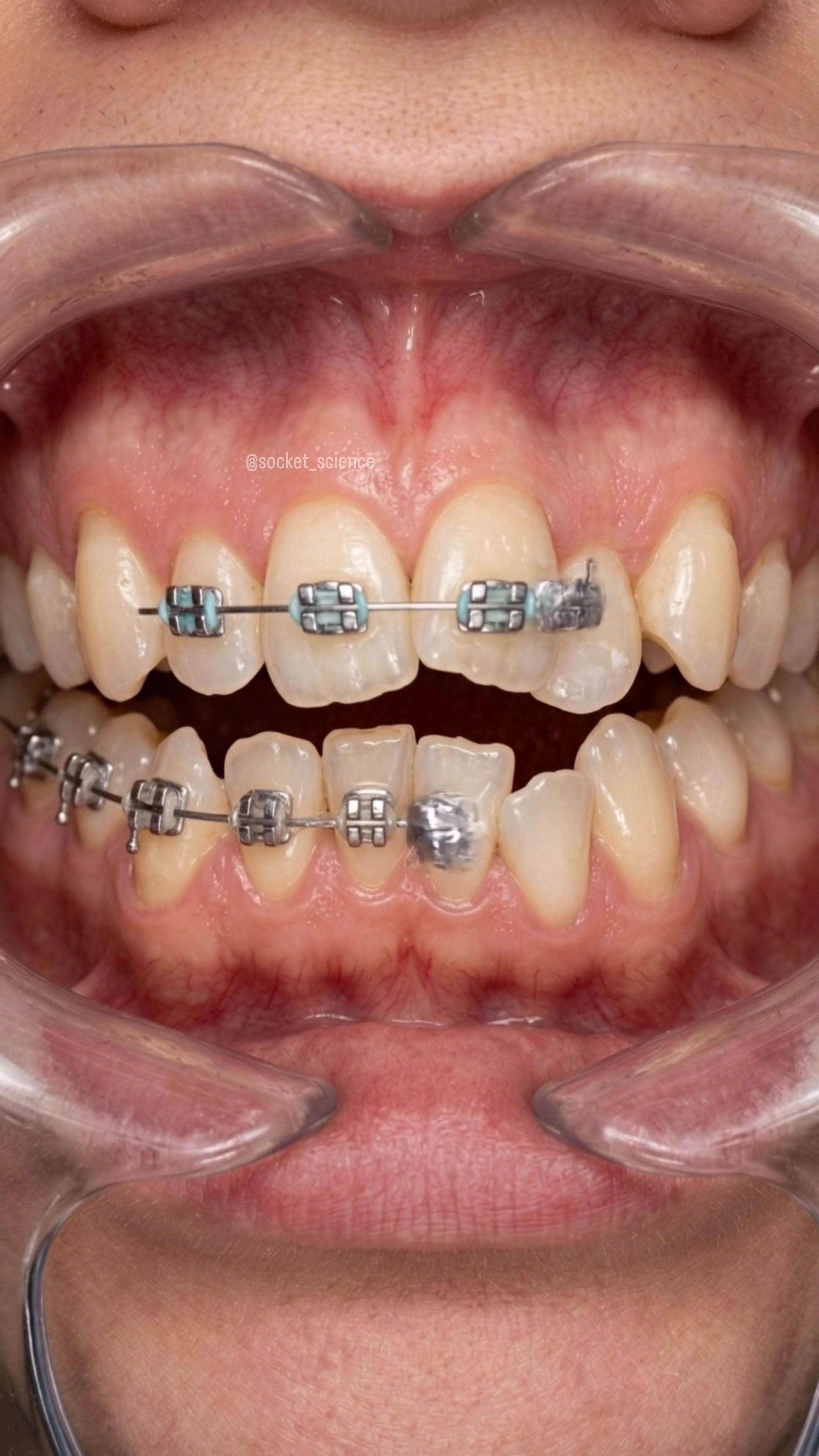 @Socket Science | Dental Visual
