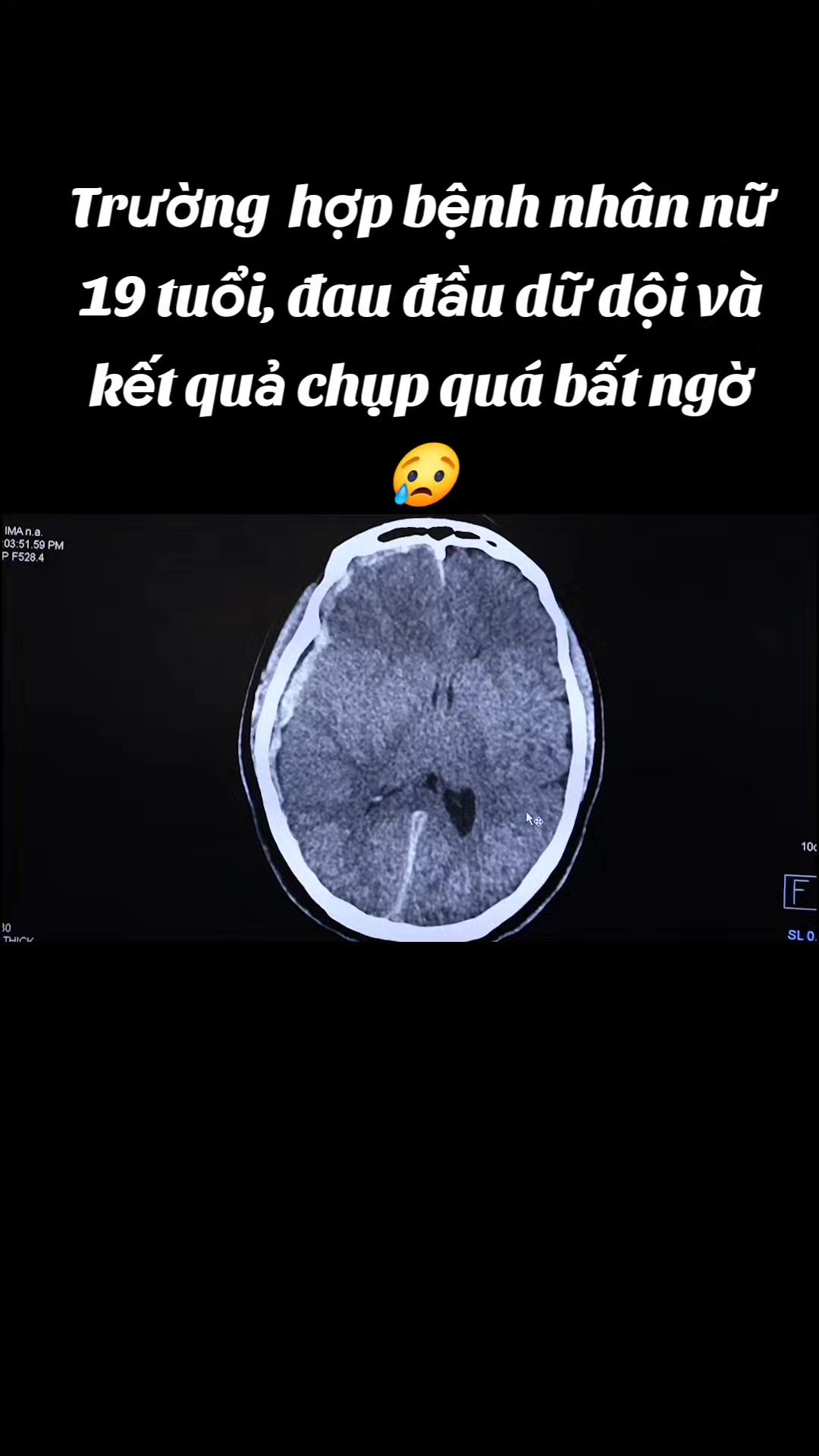 @Nguyễn Văn Tùng