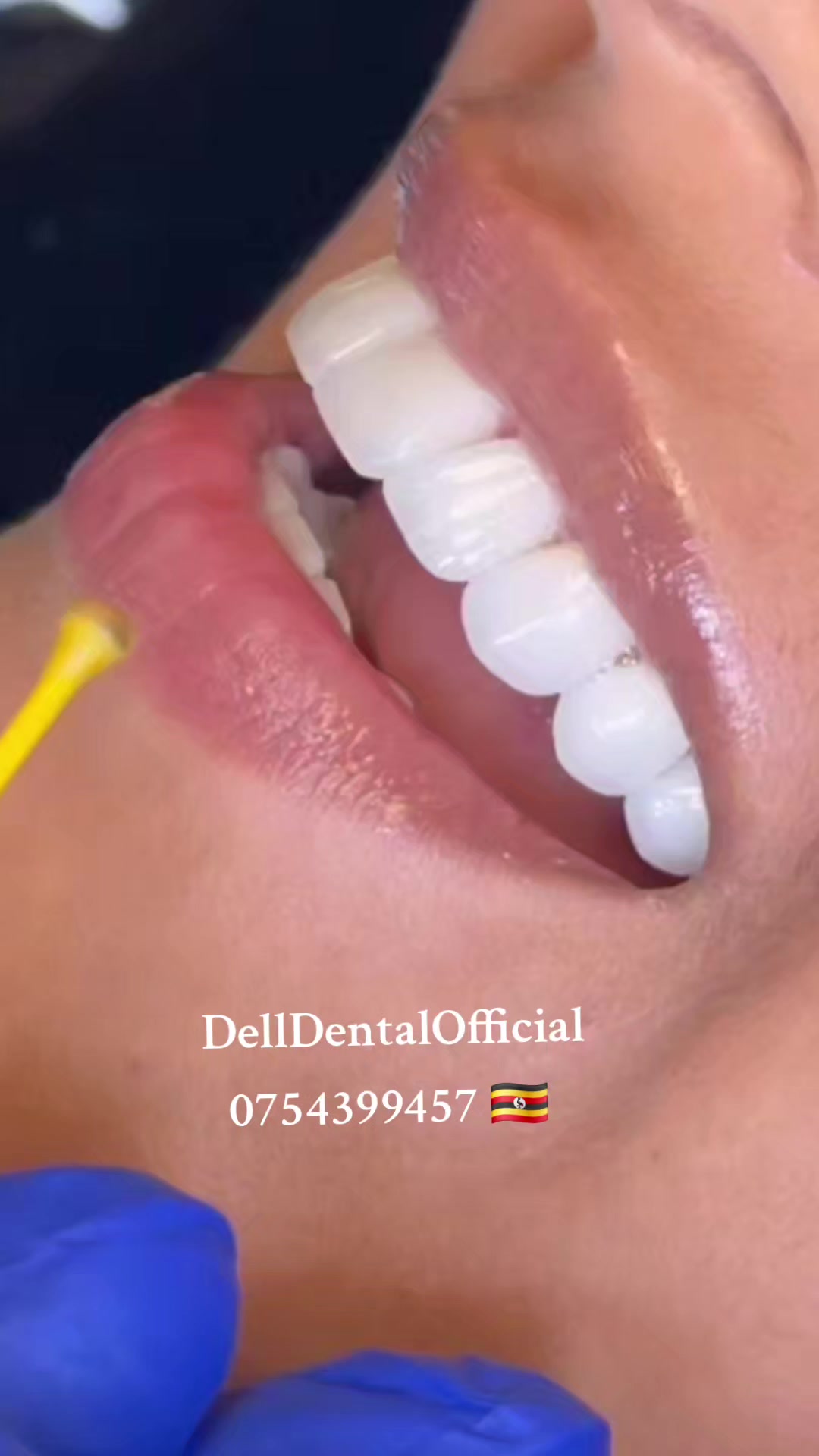 @DellDentalOfficial
