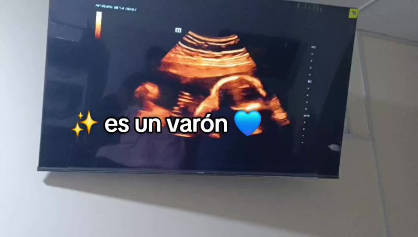 @vickely
