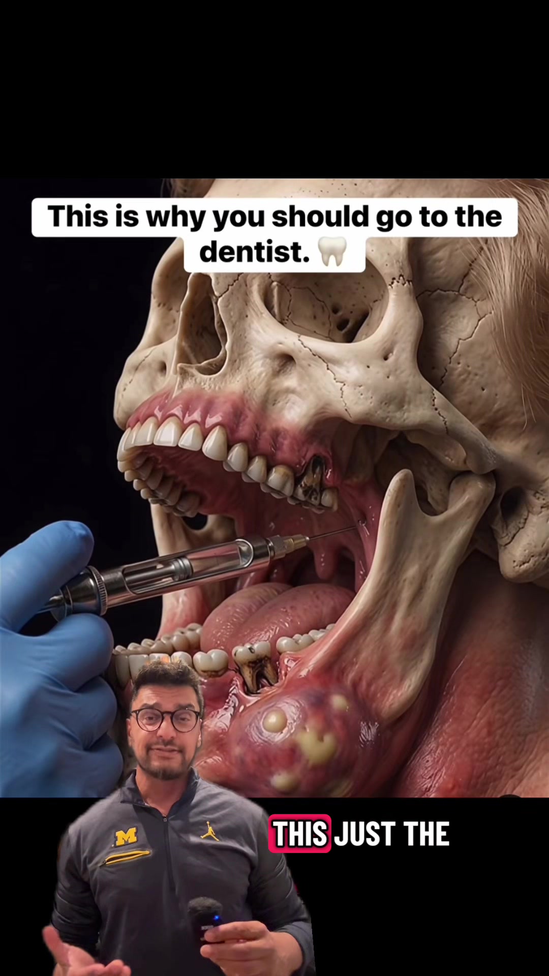 @Dentite