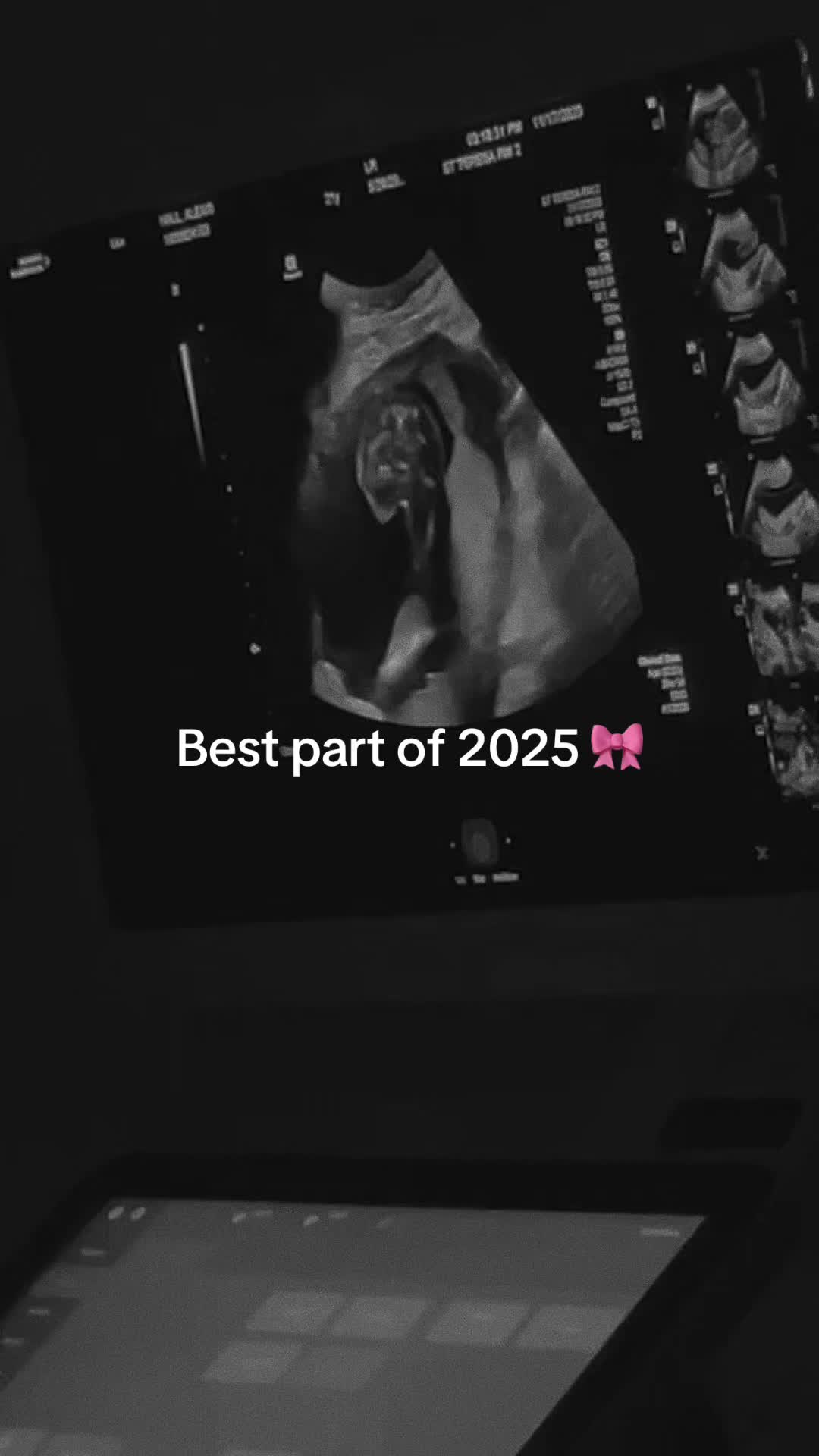 @Lexi Arellano