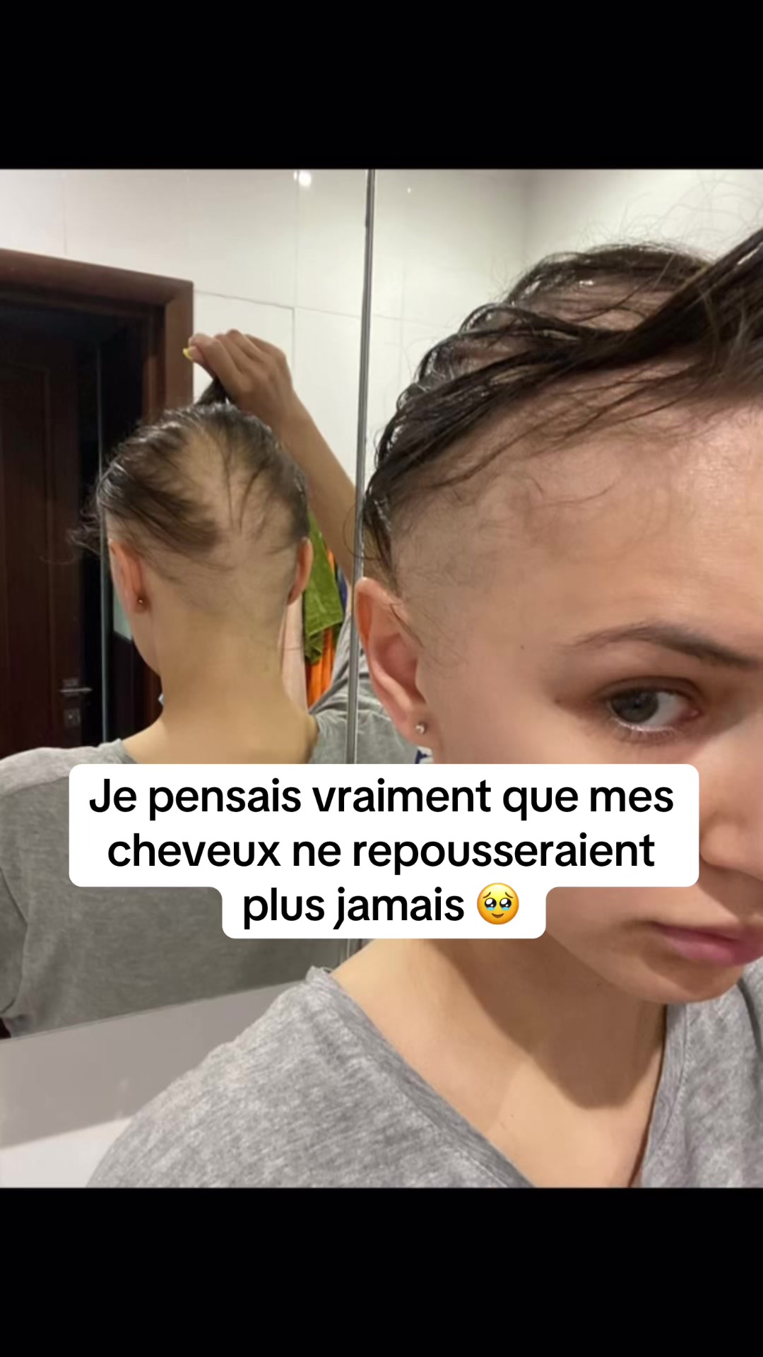 @Lux&rsquo;Hair Growth