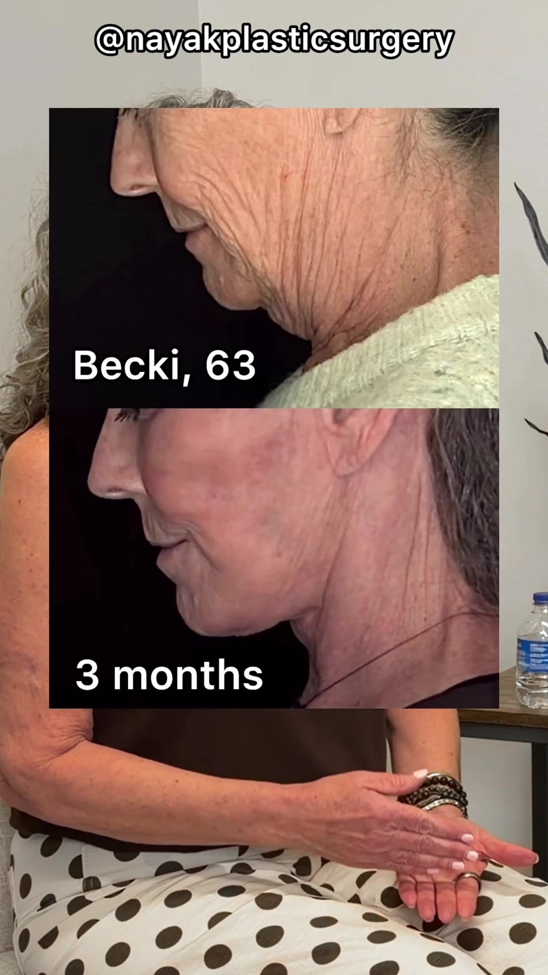 @NayakPlasticSurgery