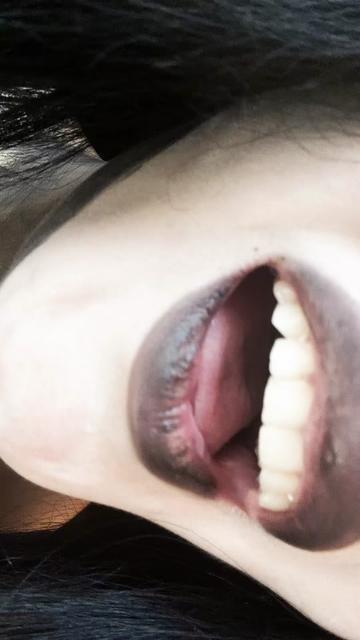 @bloodyzwingz