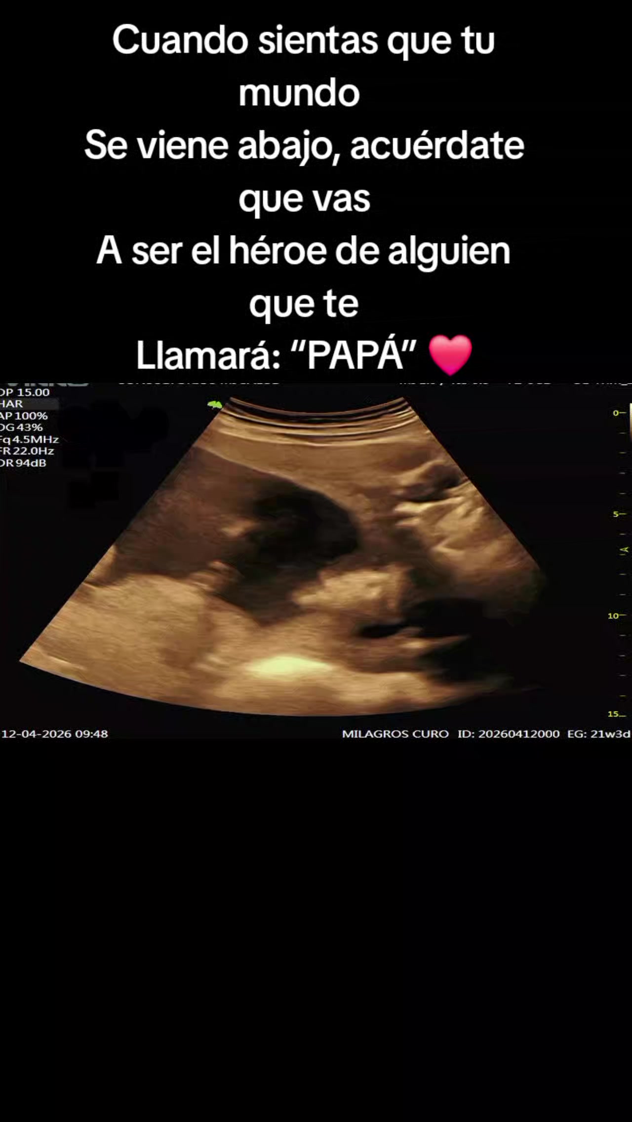 @𝓜𝓲𝓵𝓪𝓰𝓻𝓸𝓼 𝓬𝓶 💋💙