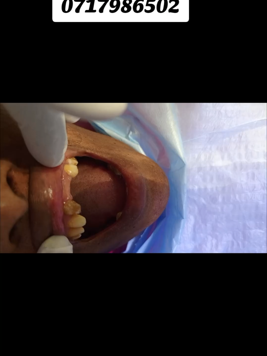 @Zabka Dental