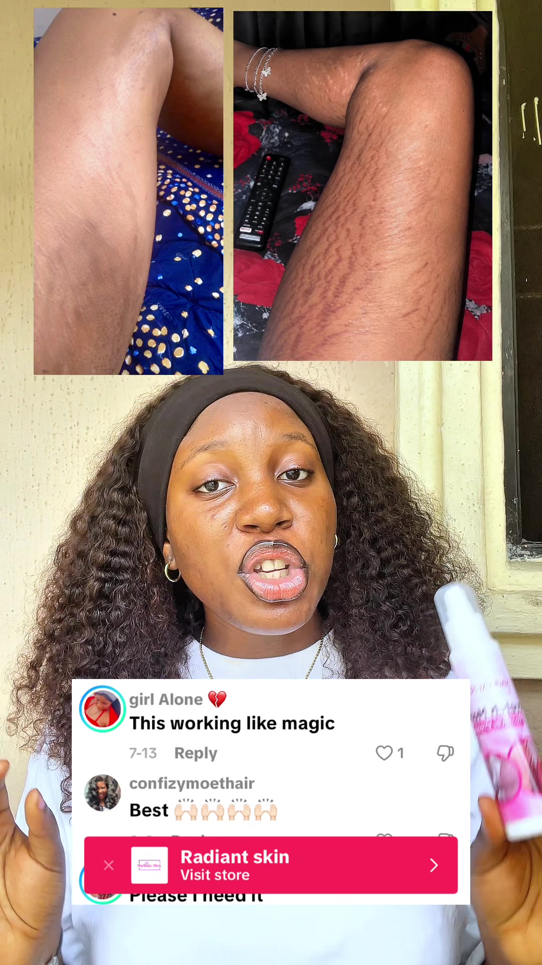 @Radiant skin