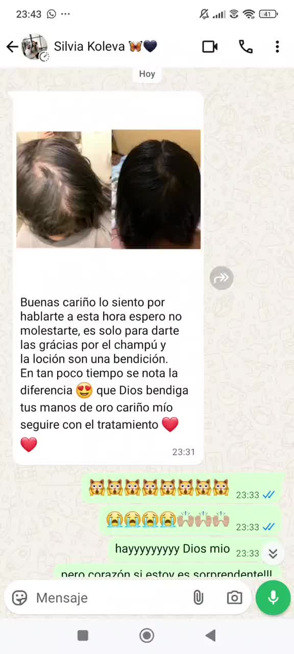 @Ester Salazar