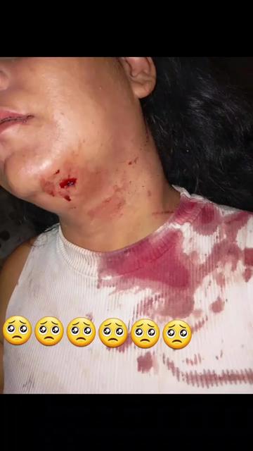 @bella