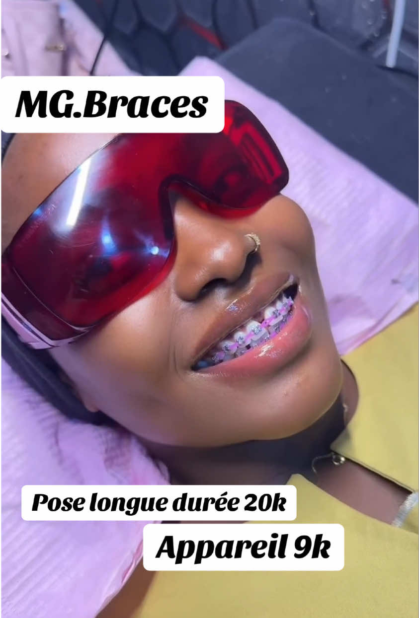 @MG BRACES