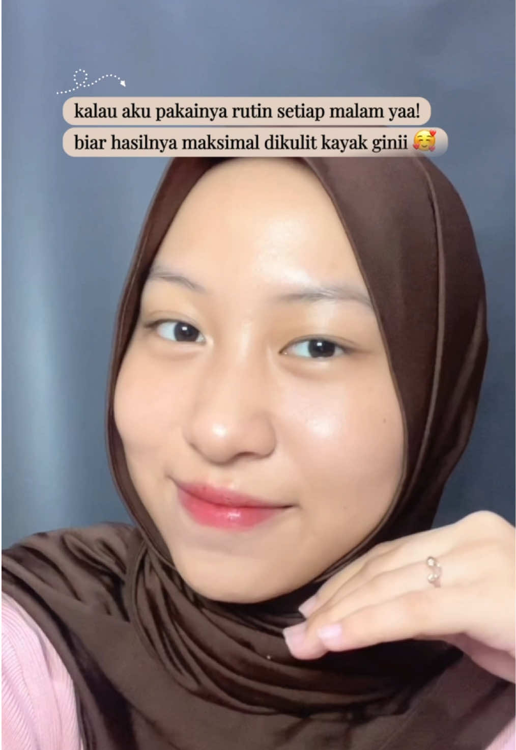 @𝑜𝓁𝒾𝓃🧸