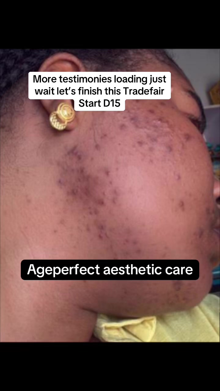 @AGE PERFECT SKINCARE ILORIN