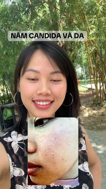 @huyendao_thaidoc