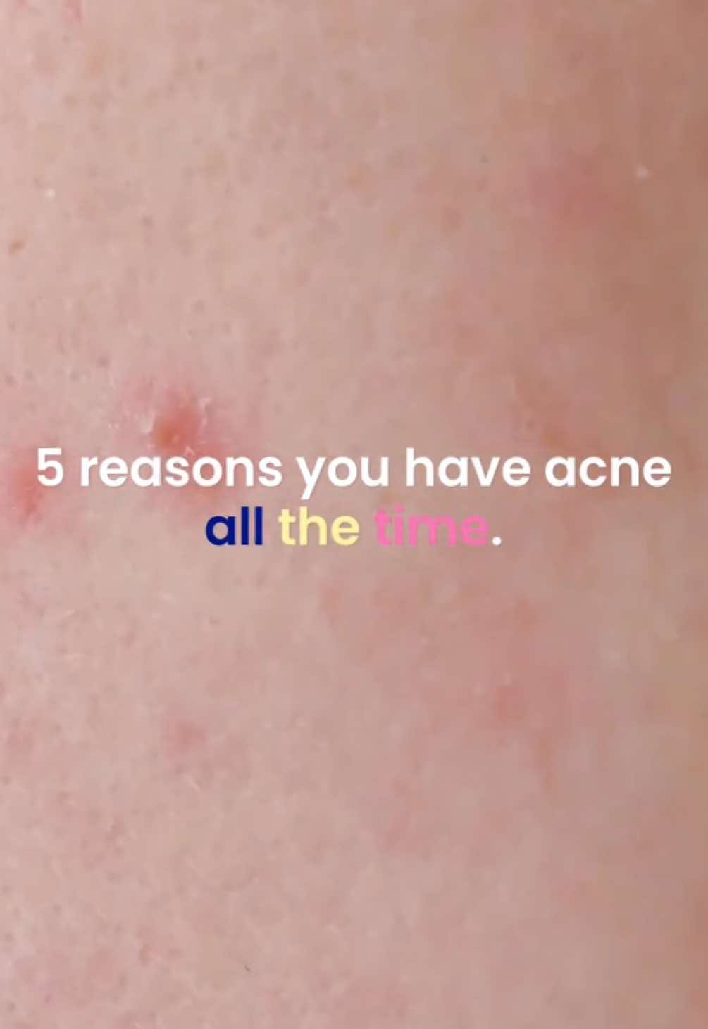 @FaceTory