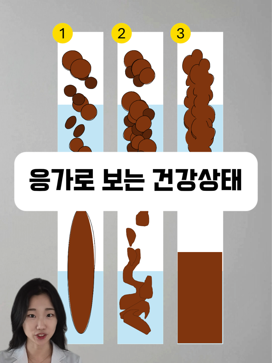 @쪼약