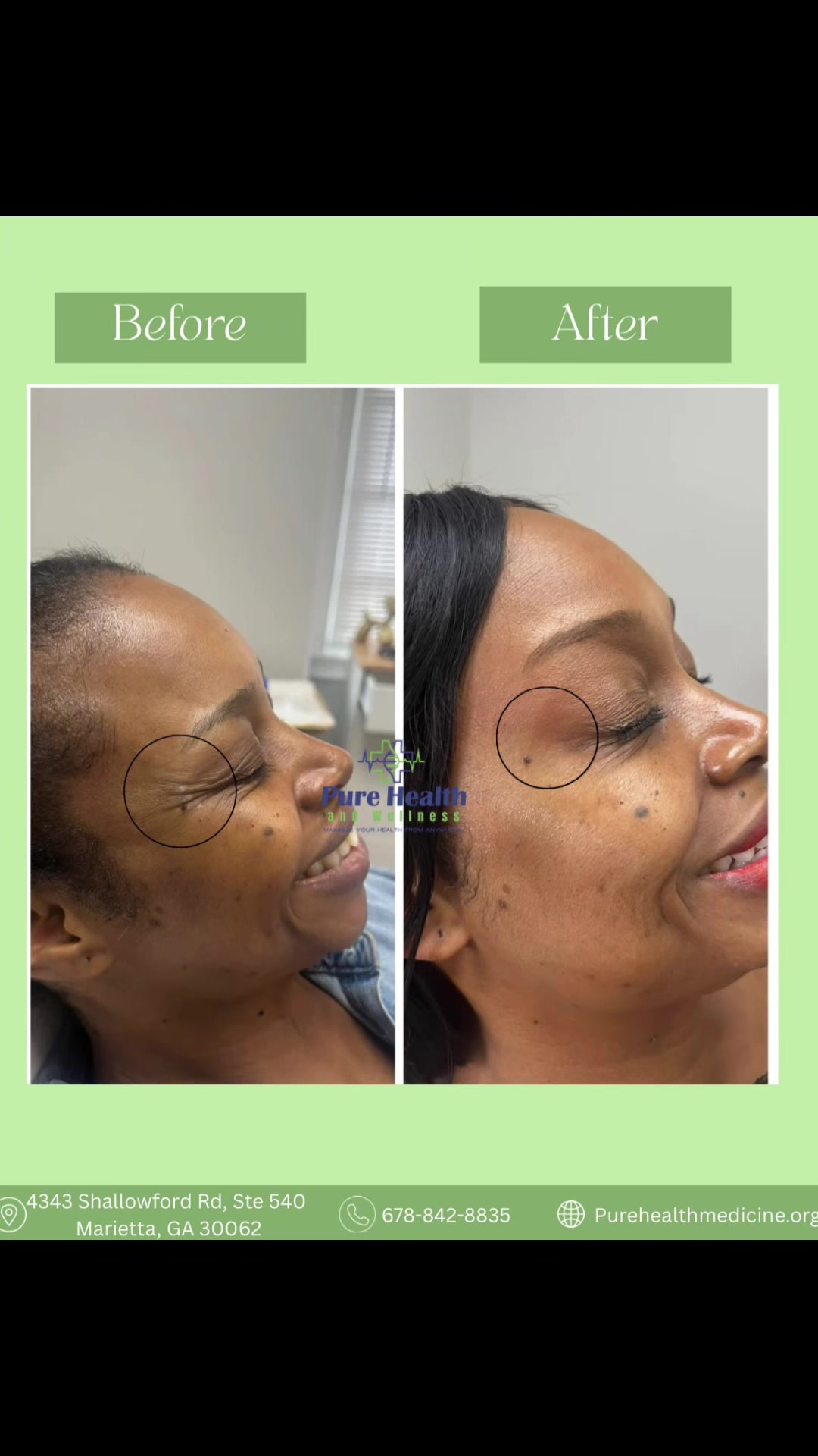 @PureHealthand_Wellness