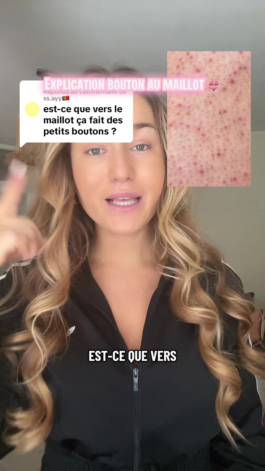 @Shavest |The Rasoir
