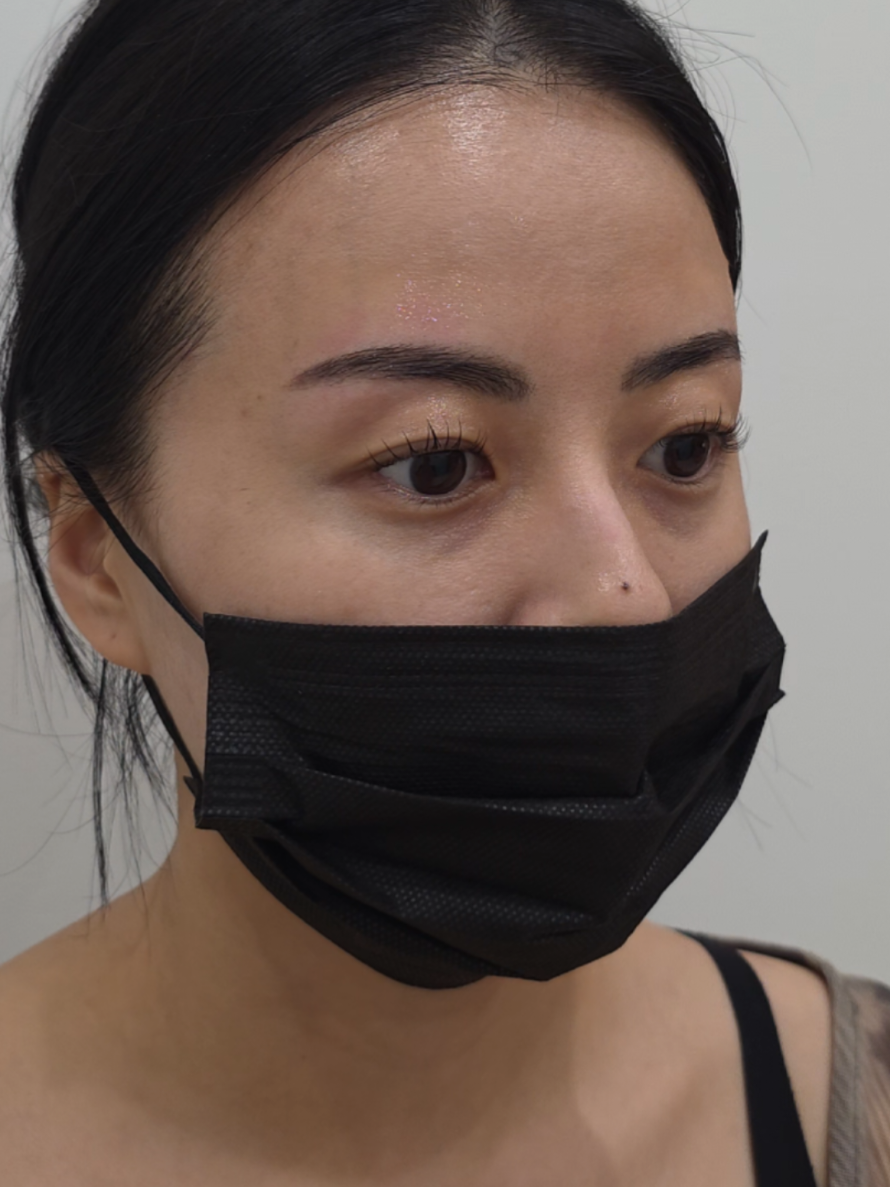 @현지
