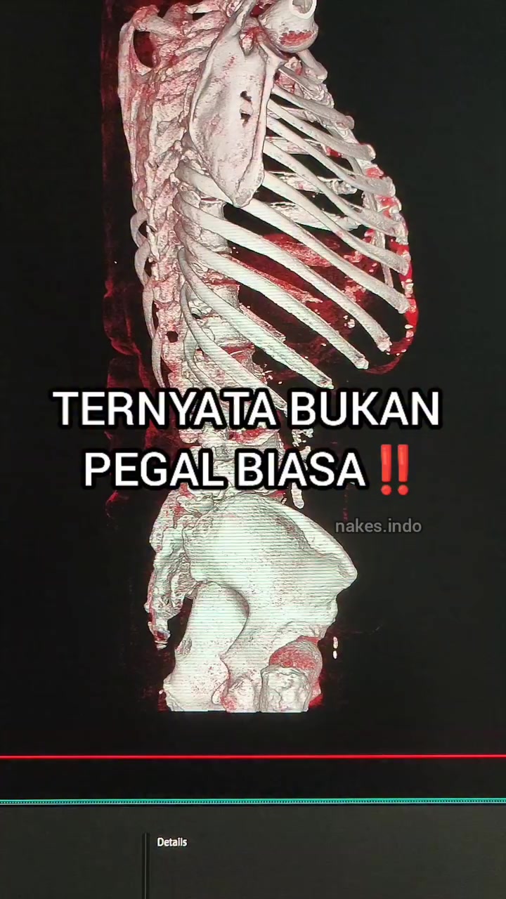@Sobat Radiology
