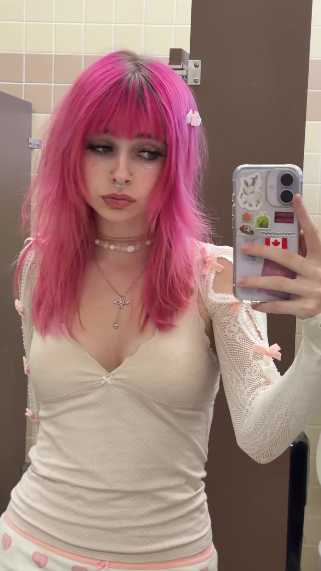 @diseasegirl3001