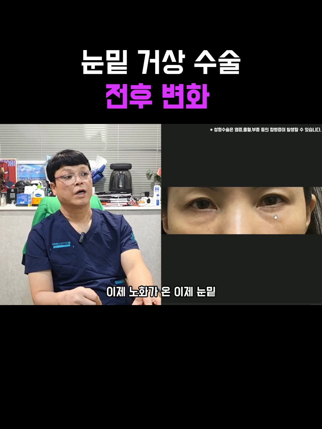 @미오름성형외과