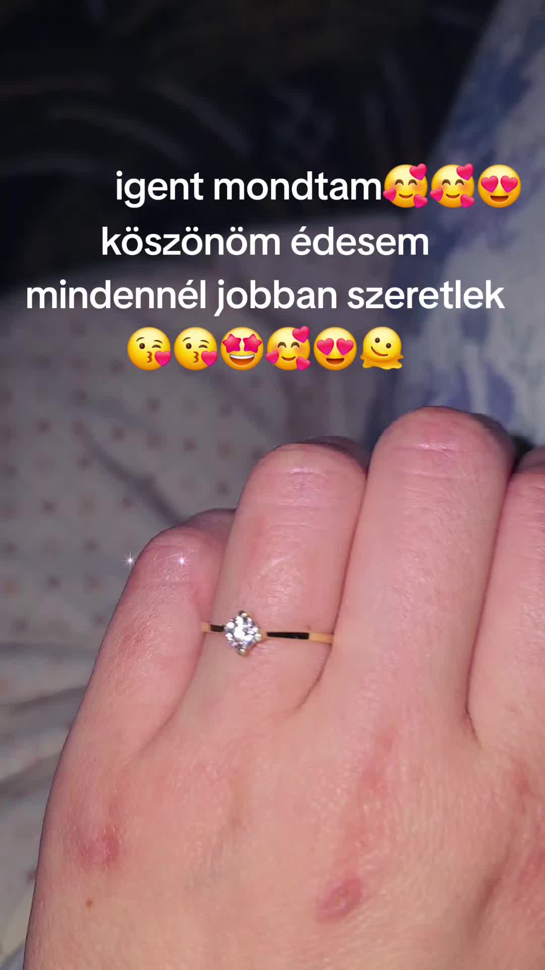 @Edina🫶🥺❤️