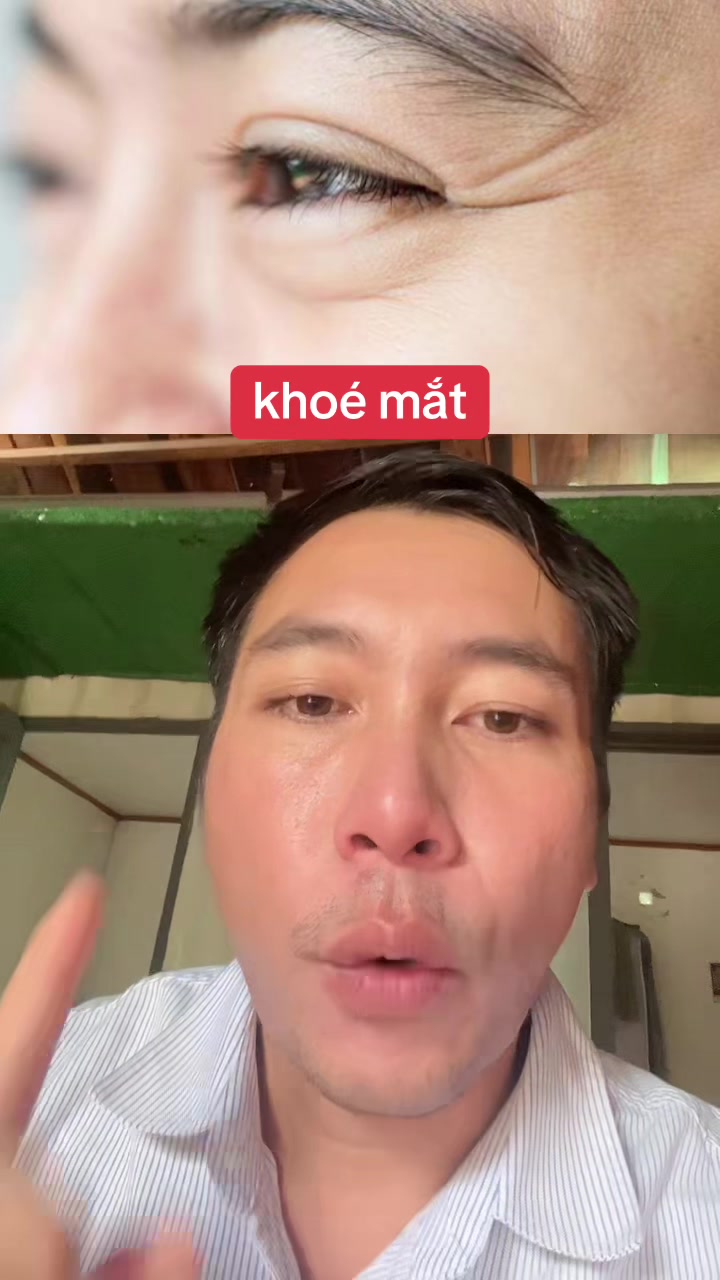 @Tuệ Nhãn ✅