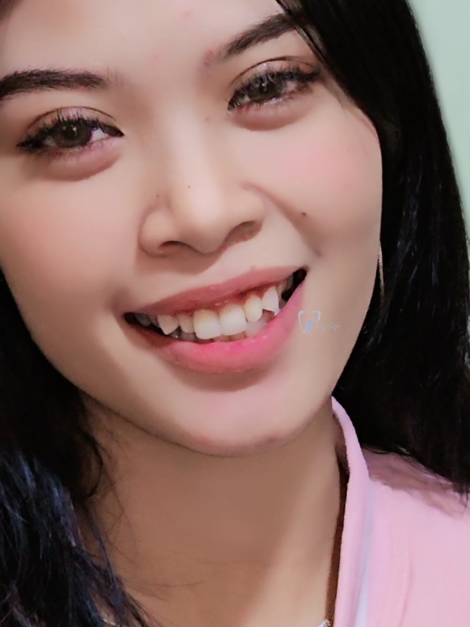 @Fiqygigi