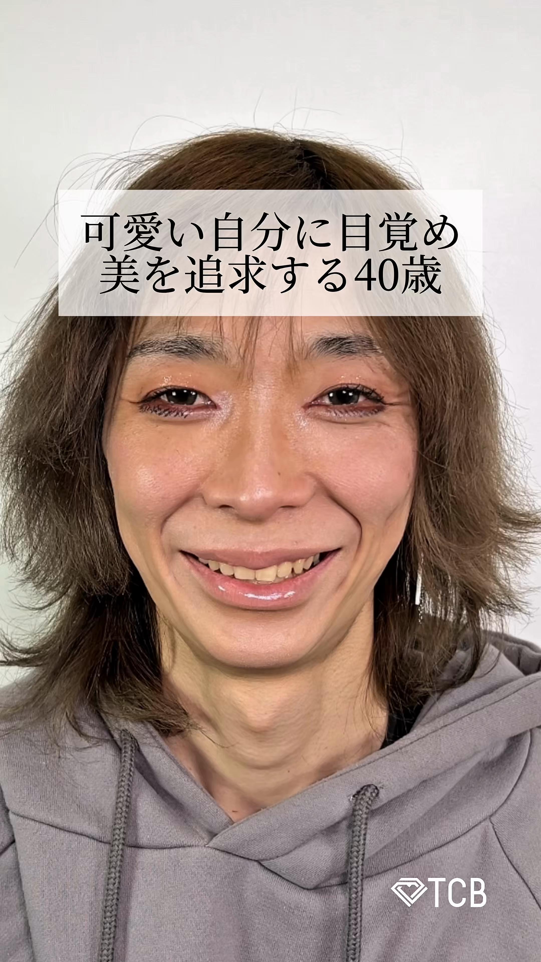 @【二重整形】TCB 新宿東口院ゆいこ先生/東京