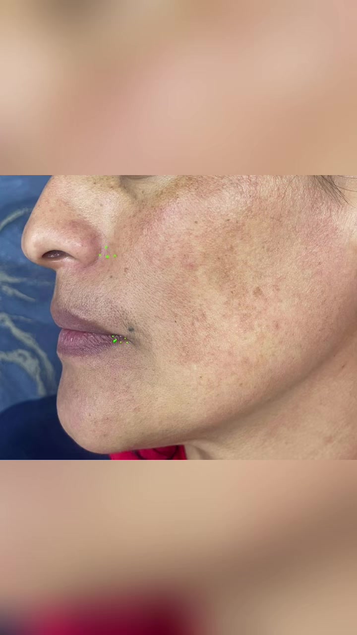 @Dra Silvia Lorena FLORES derma