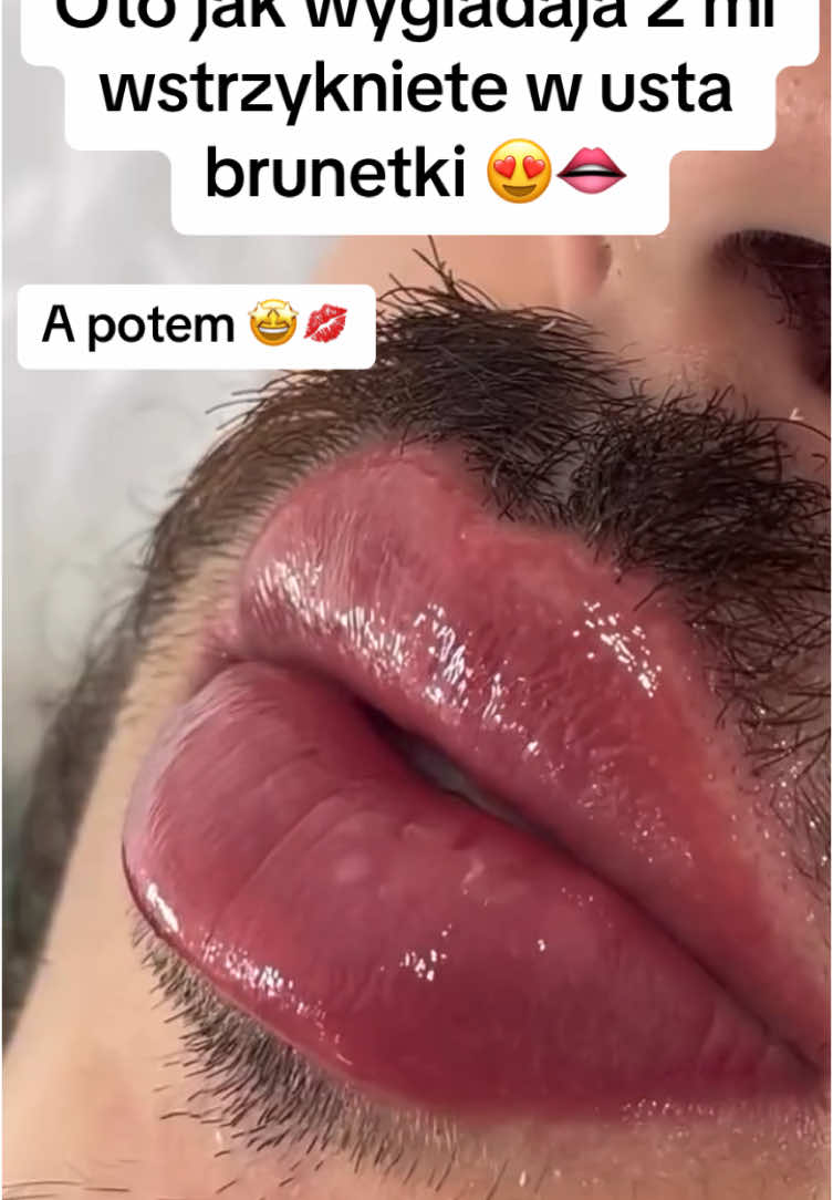 @Supreme Lips PL 🫦