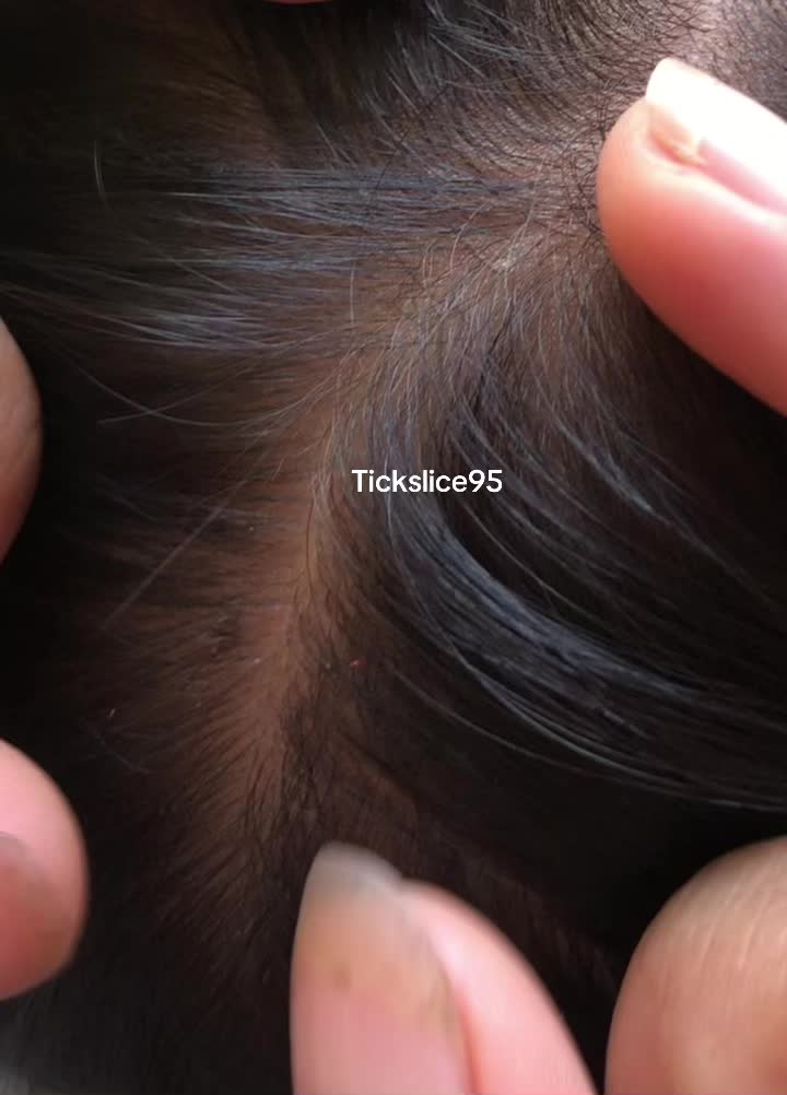 @Tickslice95