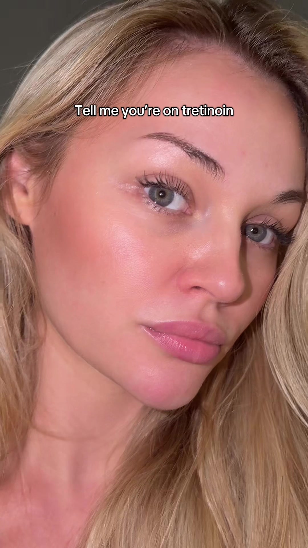 @Sara Langtved
