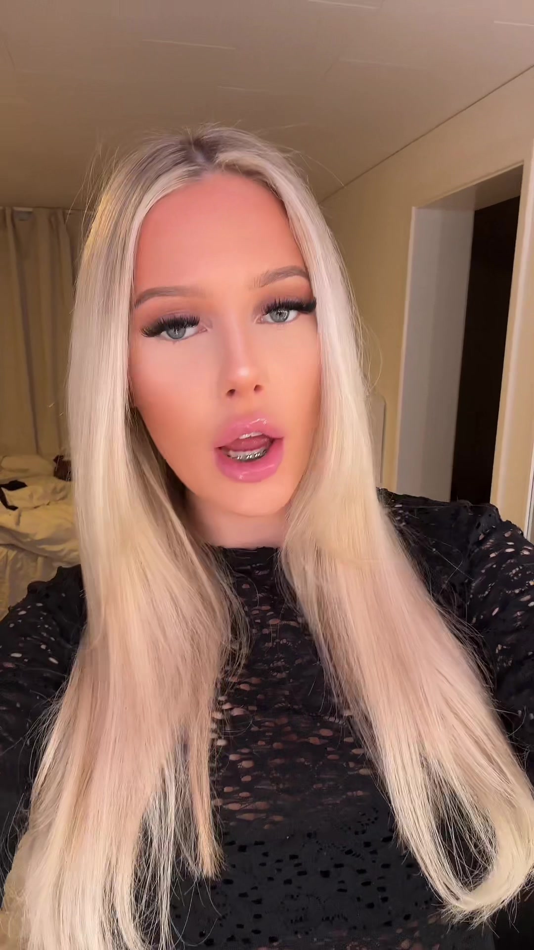 @100gumma