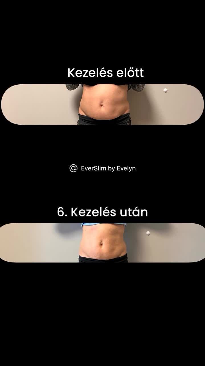 @EverSlim by Evelyn🌸