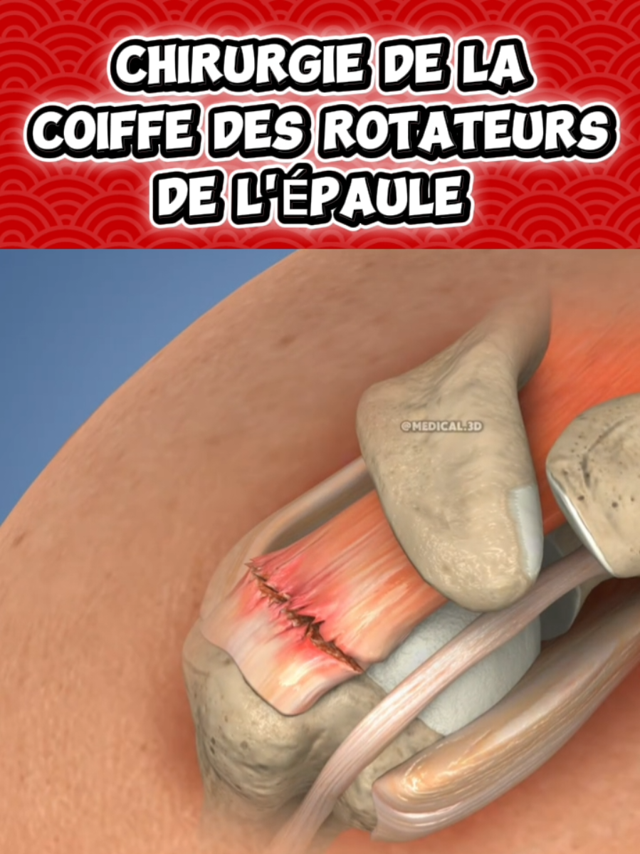 @Docteur Shepherd