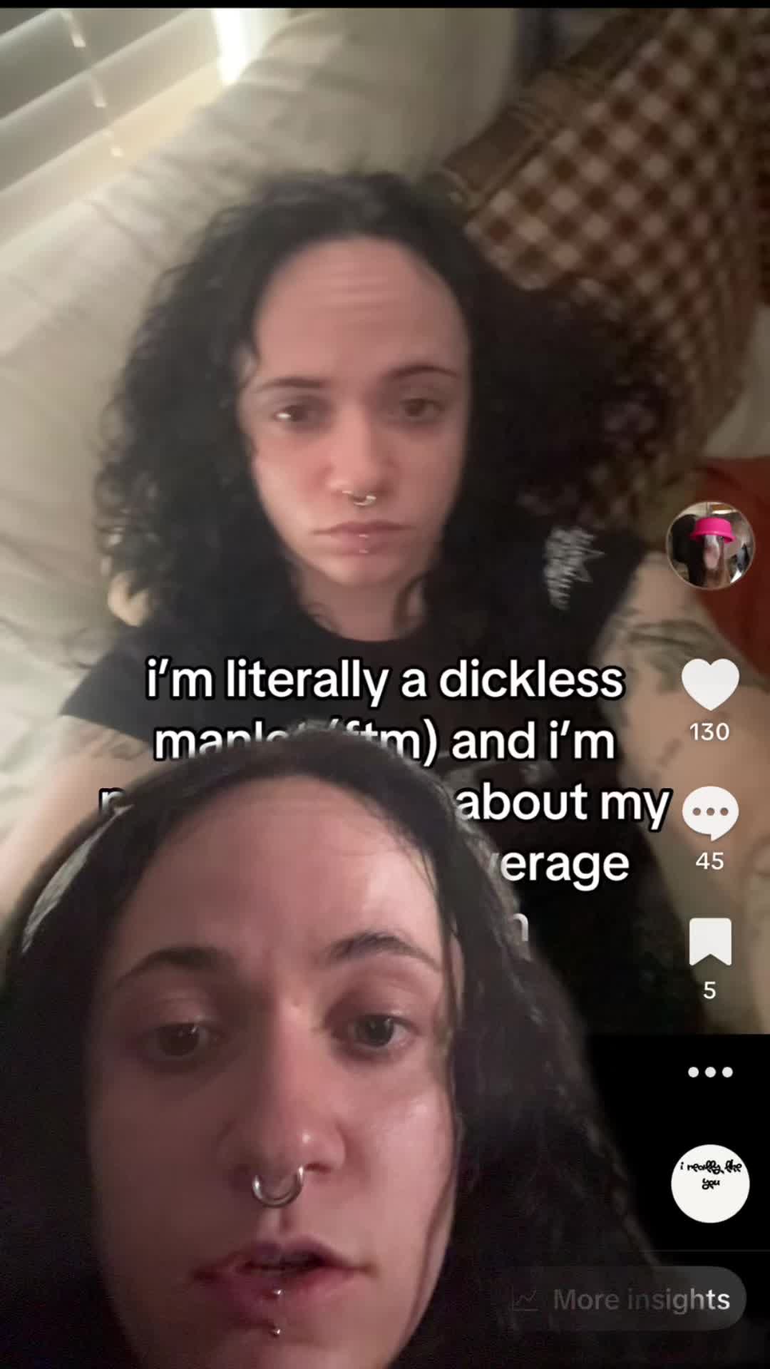 @boycervix