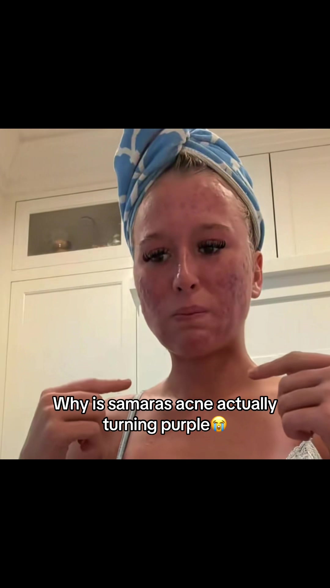 @aclyvs