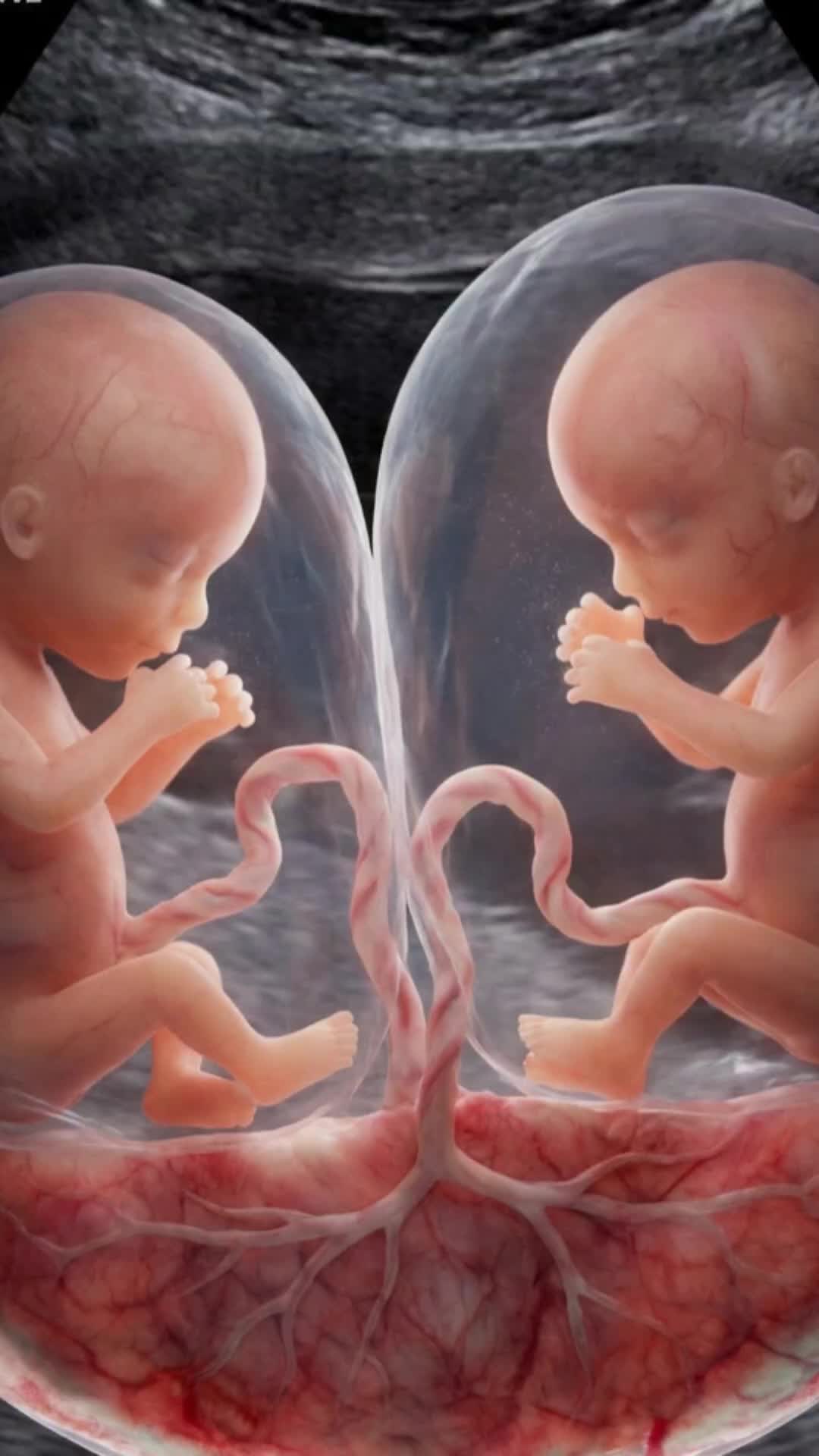 @Nurse Mum Guide
