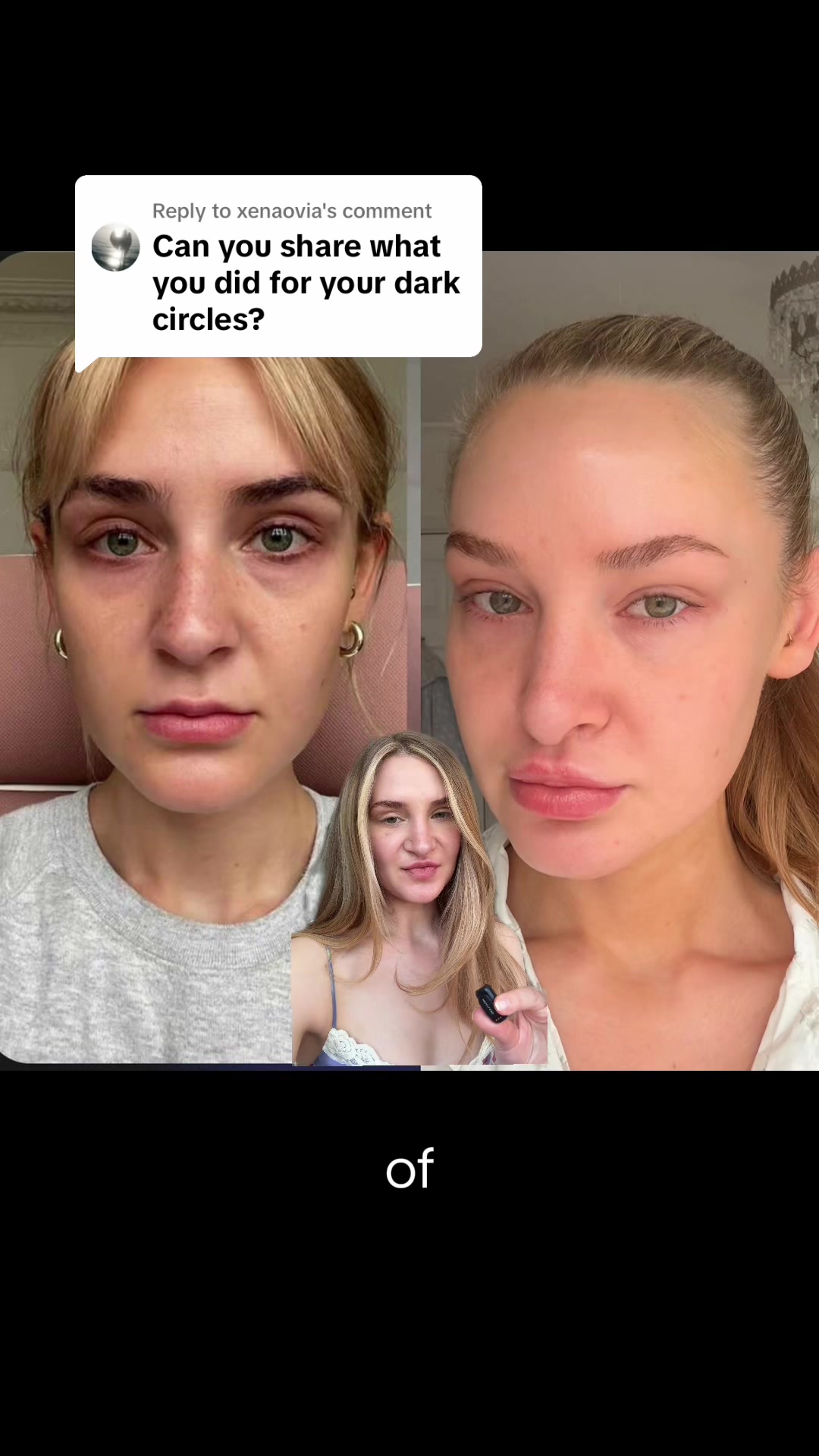 @ANNI BRØNNING