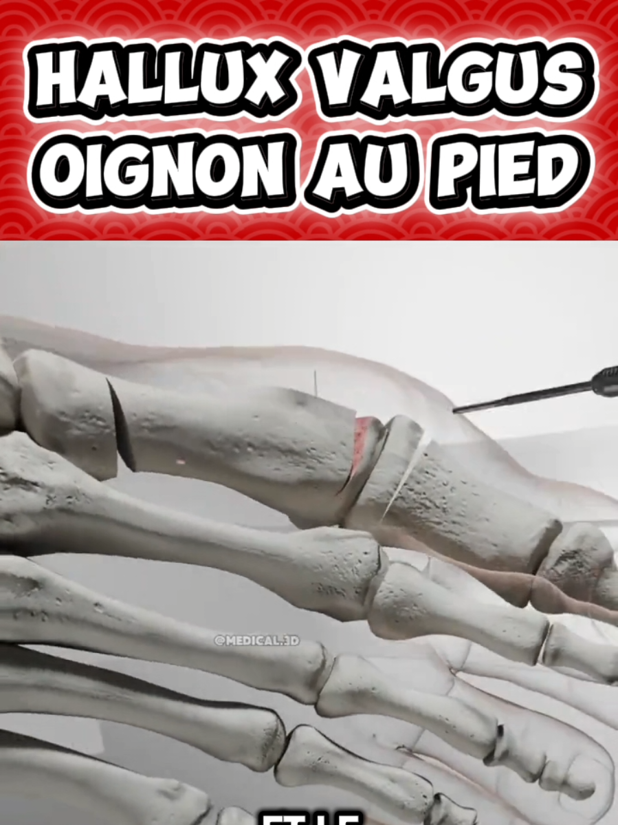 @Docteur Shepherd