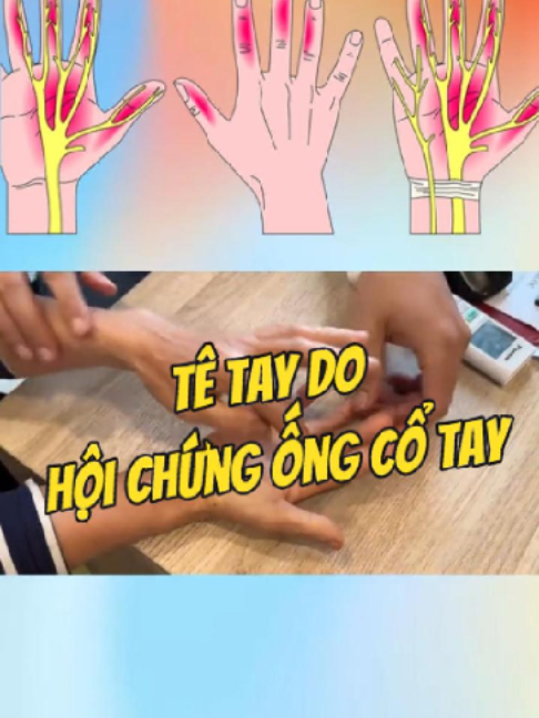 @Chuyên gia xương khớp