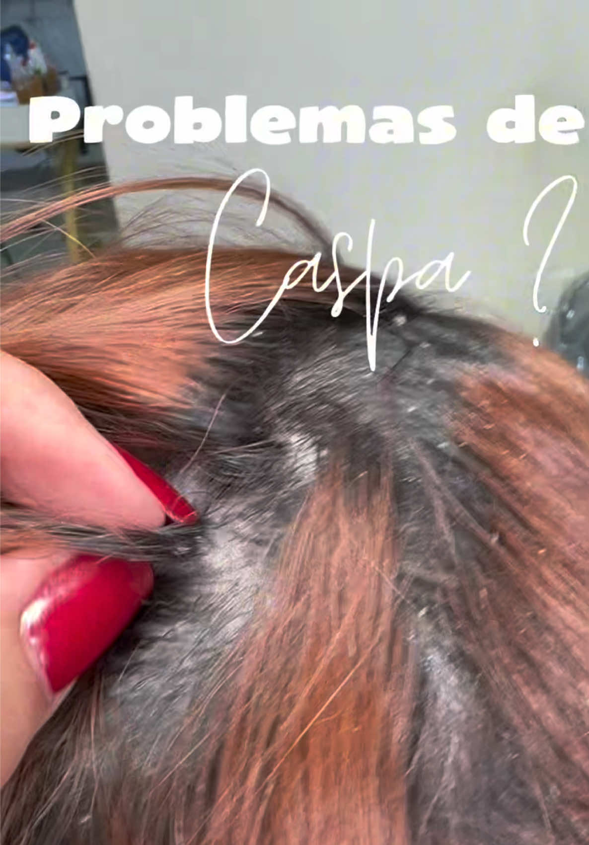 @Suyapa cuevas