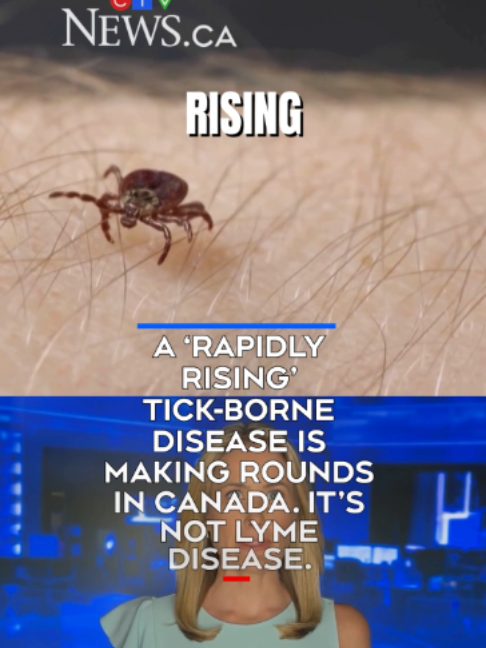 @CTVNews