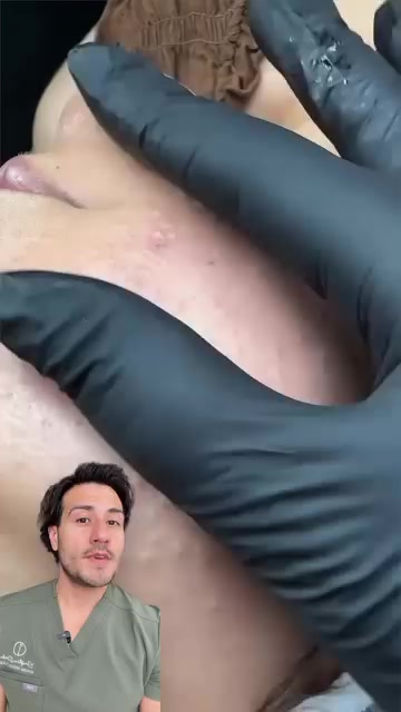 @chrisantiage