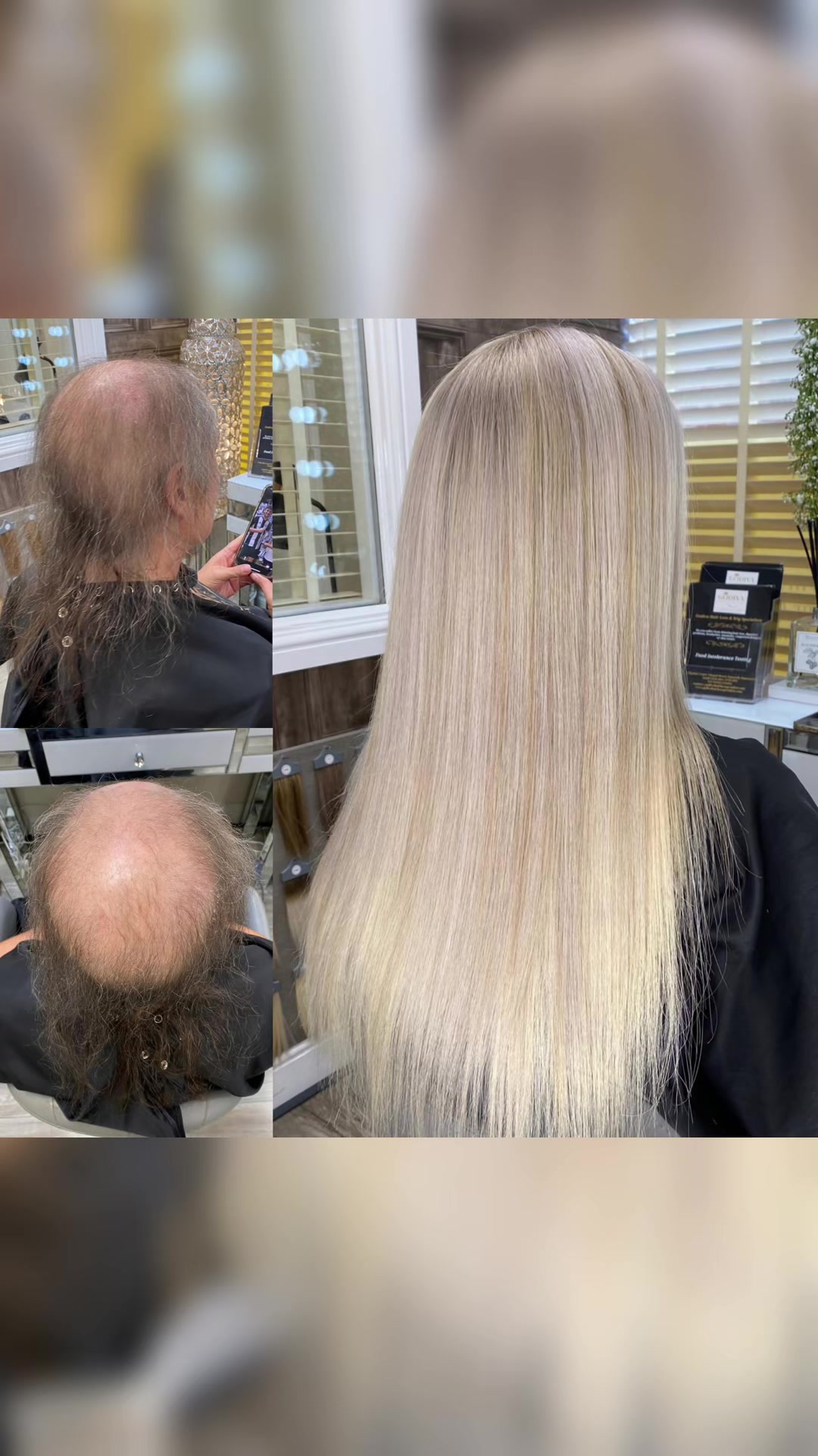 @Godiva Hair Loss Specialists