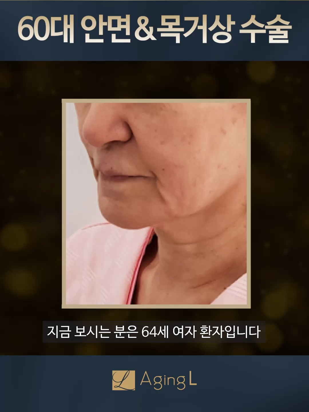 @agingl_official